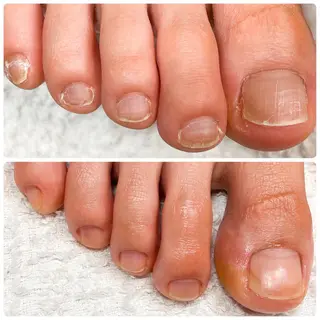 ネイル ケアが得意なサロン Happinailのエステ・リラクイメージ