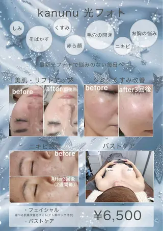 Kanunu所属・鶴橋エステ kanunuのエステ・リラクイメージ