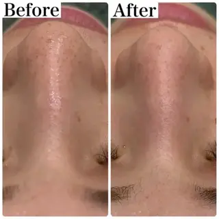 美肌脱毛サロン muroのエステ・リラクイメージ