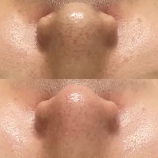 磐田｜LAYLA 一番丁寧な脱毛店のエステ・リラクイメージ