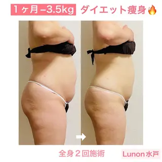 Lunon 【ルノン】のエステ・リラクイメージ