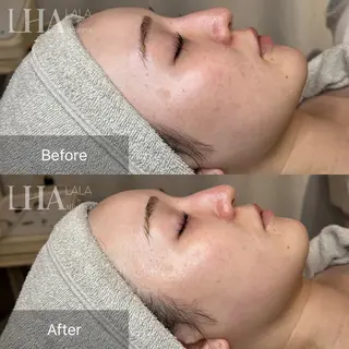 GAKU 【IGO】のエステ・リラクイメージ