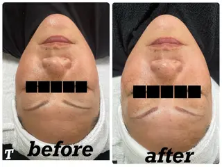 ÉMIA ✴︎のエステ・リラクイメージ