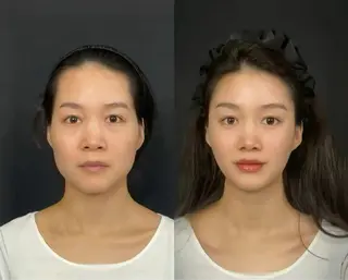 カラー aliaハイフ&水光ジェットサロン所属・aliaハーブ水光店 エステティシャン募集のエステ・リラクイメージ