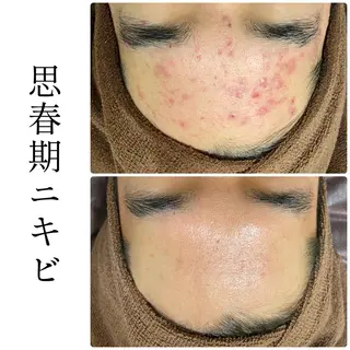 ハーブピーリング専門 BIOEL横浜のエステ・リラクイメージ