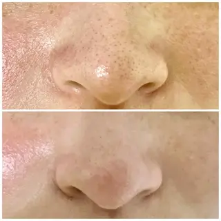 Lim Naomiのマツエク・マツパデザイン