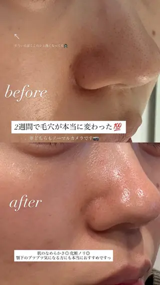 【vidyto】ヴィディトゥ所属・肌管理サロン vidyto　MOEのエステ・リラクイメージ