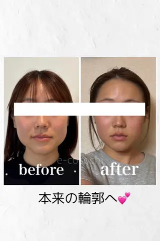 小顔と ヘッドスパのお店のエステ・リラクイメージ