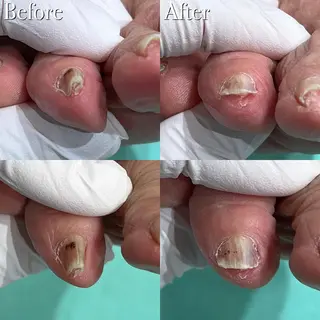 東京巻き爪アカデミー所属・東京巻き爪 アカデミーのエステ・リラクイメージ