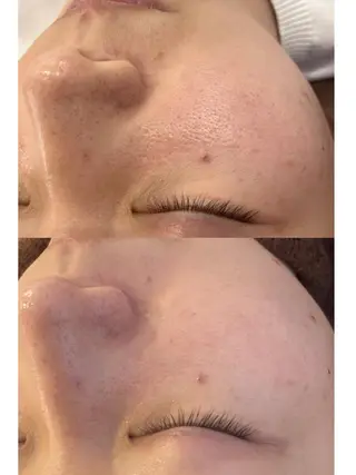 Freude所属・Freude Yamaguchiのマツエク・マツパデザイン