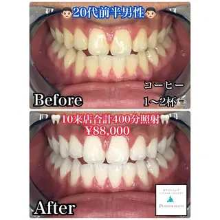 ホワイトニングビューティー西宮店所属・ホワイトニングビュー ティー西宮店のその他イメージ