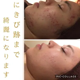 ミディアム カラー パーマ ヘアアレンジ メンズ キッズ ネイル マツエク・マツパ ニキビ・肌質改善専門 ♡人生が変わるサロンのエステ・リラクイメージ