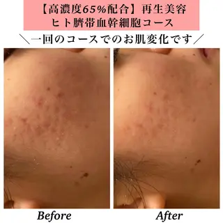 Bellesthe （ベルエステ）のエステ・リラクイメージ