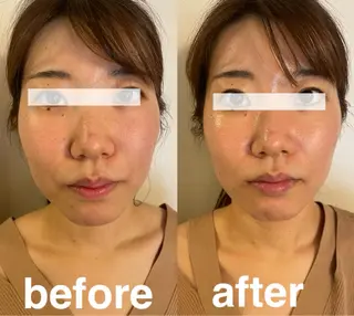 美容鍼灸サロン mahoroba院長のエステ・リラクイメージ