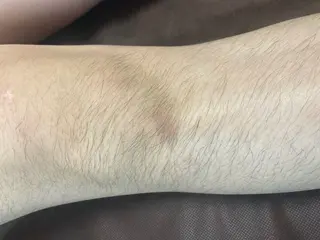 磐田｜LAYLA 一番丁寧な脱毛店のエステ・リラクイメージ