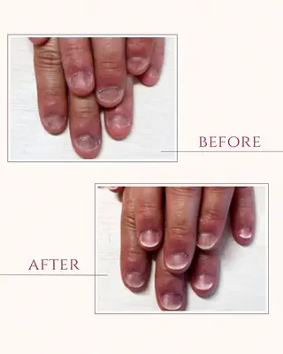 ネイル 深爪矯正・自爪育成 ヴェールリムのネイルデザイン