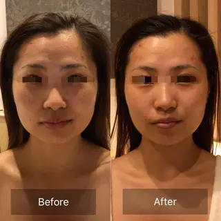 Hi, I am 1 PARAFUSE.所属・カラダとココロ 癒されほっと一息のエステ・リラクイメージ