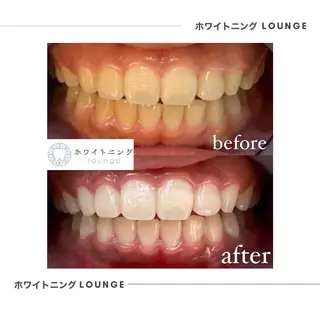 ホワイトニングラウンジ横須賀所属・ホワイトニング Lounge横須賀のその他イメージ
