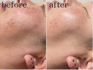 ビューティーサロン　ア・クイーユ所属・ビューティーサロン ア・クイーユのエステ・リラクイメージ