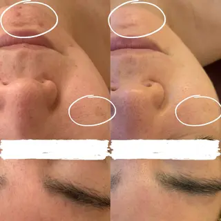 小顔&デコルテ Spa　“koti”のエステ・リラクイメージ