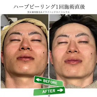 メンズ 男女兼用脱毛&ドライ ヘッドスパ トレテルのエステ・リラクイメージ