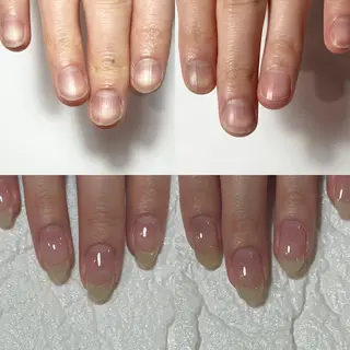 ネイル 自爪育成・巻き爪 補正講師　津蔵のネイルデザイン