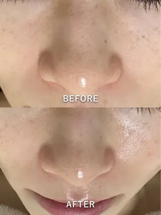 韓国美肌/肌質改善 【天神】yuiのエステ・リラクイメージ