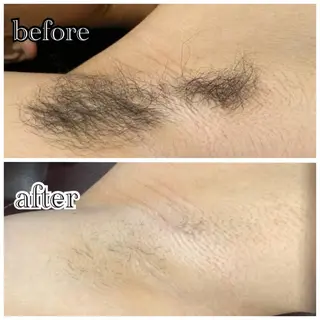 メンズ メンズ脱毛サロン　SHINKA所属・メンズ脱毛サロン SHINKAのエステ・リラクイメージ