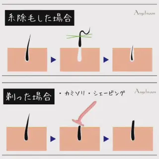 若返り 美肌   エステサロンららんのエステ・リラクイメージ