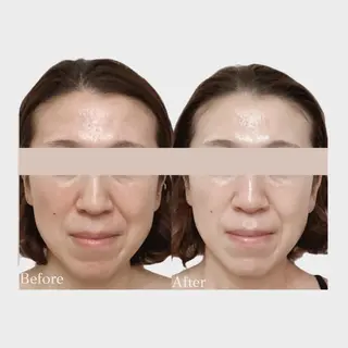 看護師 AYUIのエステ・リラクイメージ