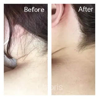 川越ローマピンク 光脱毛＆ワックス脱毛のエステ・リラクイメージ