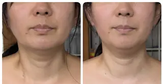 はなえみの森所属・上戸 千瑞のエステ・リラクイメージ