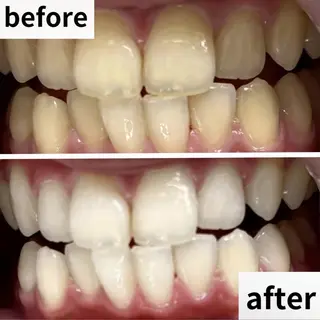 LBSホワイトニング 🌐渋谷店 小河原のエステ・リラクイメージ