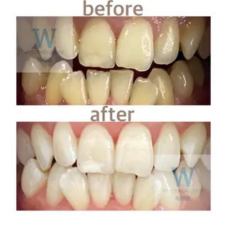 ホワイトニング ショップ船橋店🦷のエステ・リラクイメージ