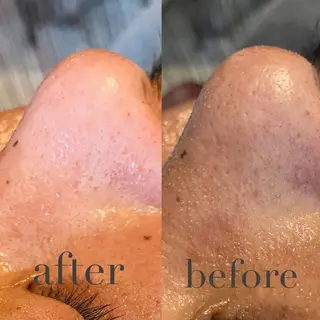 N&H所属・Ｎ＆Ｈ salonのエステ・リラクイメージ