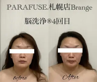 PARAFUSE.札幌店Brange所属・佐藤 陽子のエステ・リラクイメージ