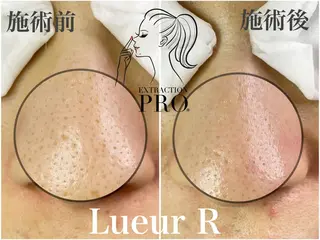 大久保 里奈のエステ・リラクイメージ