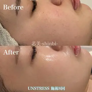 芯美-Shinbi- rinaのエステ・リラクイメージ