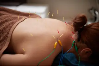 美楽鍼 びらくしんのその他イメージ