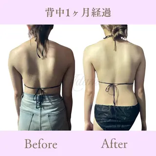 Adam 上半身美人のエステ・リラクイメージ