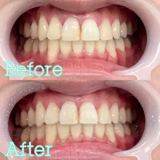 歯のホワイトニング専門店 MIGAQ 京都四条大宮店所属・佐藤 未来の眉毛・アイブロウイメージ