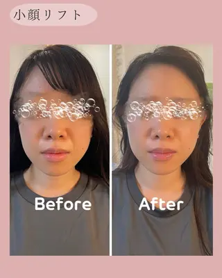 NICORI　小顔&肌質改善専門店所属・小顔＆肌質改善 NICORIのエステ・リラクイメージ