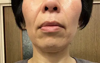 ドライヘッドスパ KilaKilaのエステ・リラクイメージ