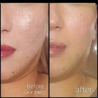 オーガニックエステ サロン　Graceのエステ・リラクイメージ