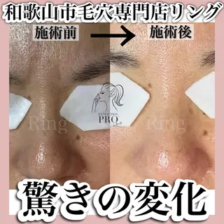 和歌山　毛穴専門店 Ringのエステ・リラクイメージ