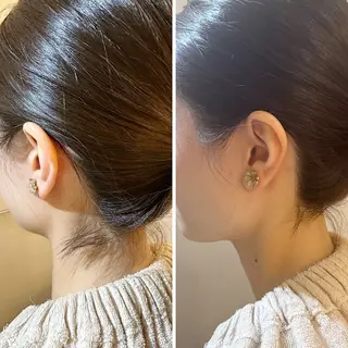 うなじ脱毛/美肌脱毛 LABELのエステ・リラクイメージ