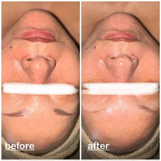 mignon miyuのエステ・リラクイメージ