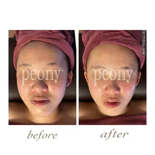 デトックス美容専門サロンｐｅｏｎｙ所属・デトックス美容専門 サロンｐｅｏｎｙのエステ・リラクイメージ