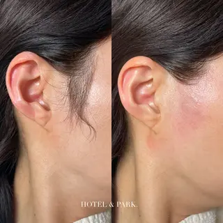 HOTEL&PARK . ワックス脱毛のエステ・リラクイメージ