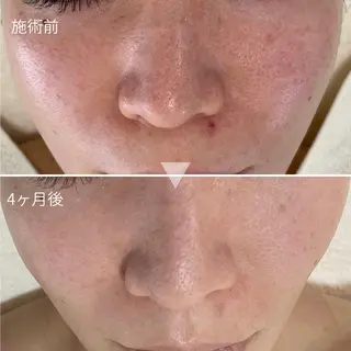 シェノン所属・ニキビ・毛穴・ フェイシャル専門店のエステ・リラクイメージ